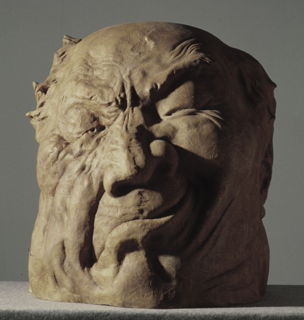 政治家的顏面肌肉壞死病