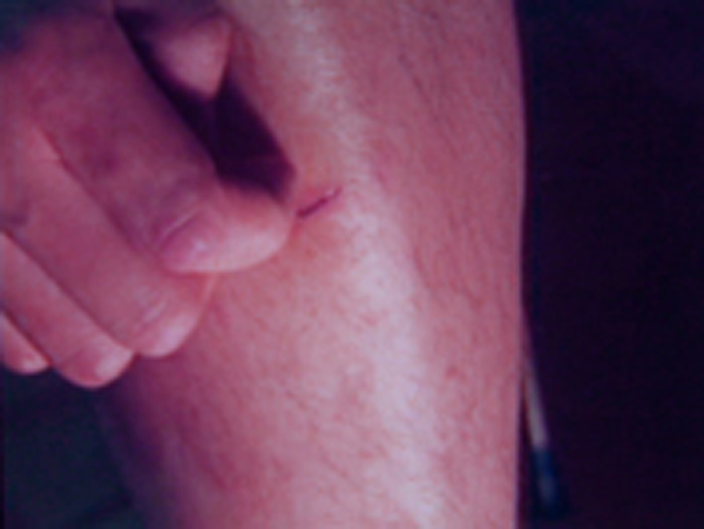5hym-03-