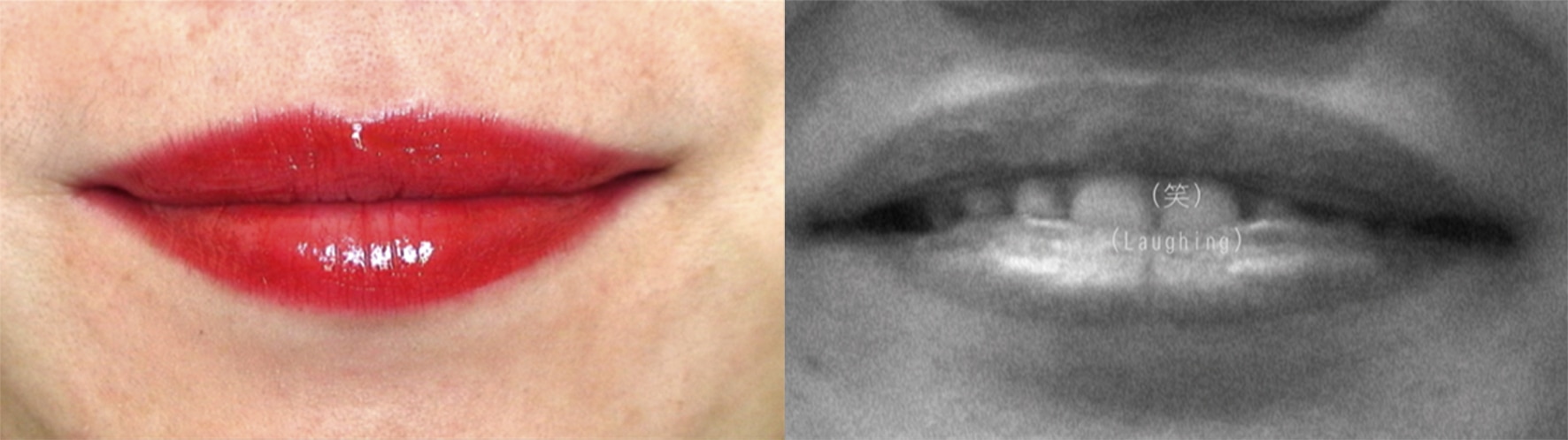 ourlip-frame-01_1_orig
