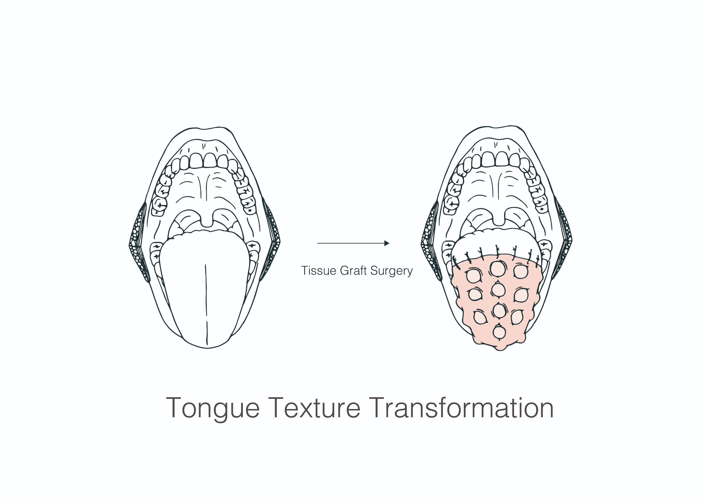 The-Cunnilingus_Anilingus-Modification-Project1