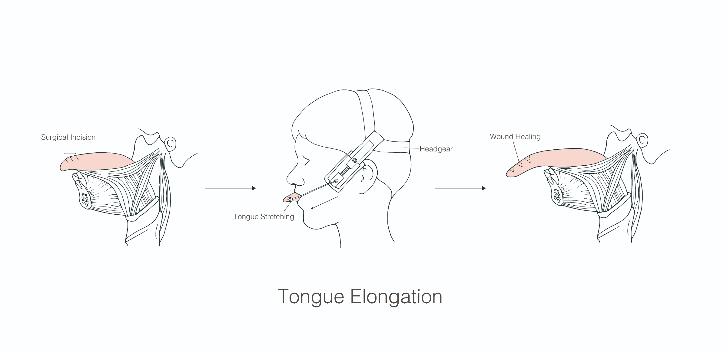 The-Cunnilingus_Anilingus-Modification-Project2