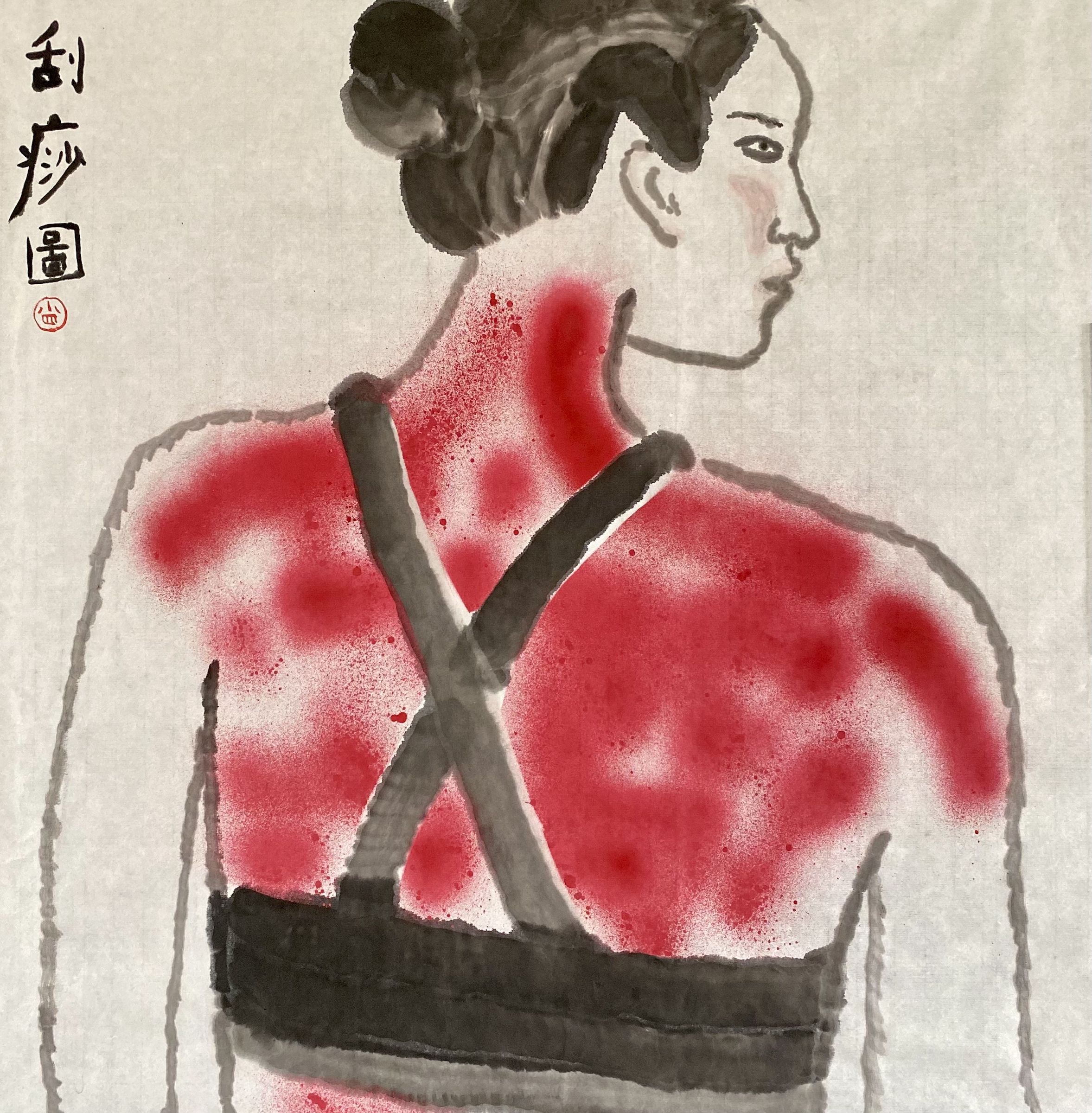 刮痧圖3