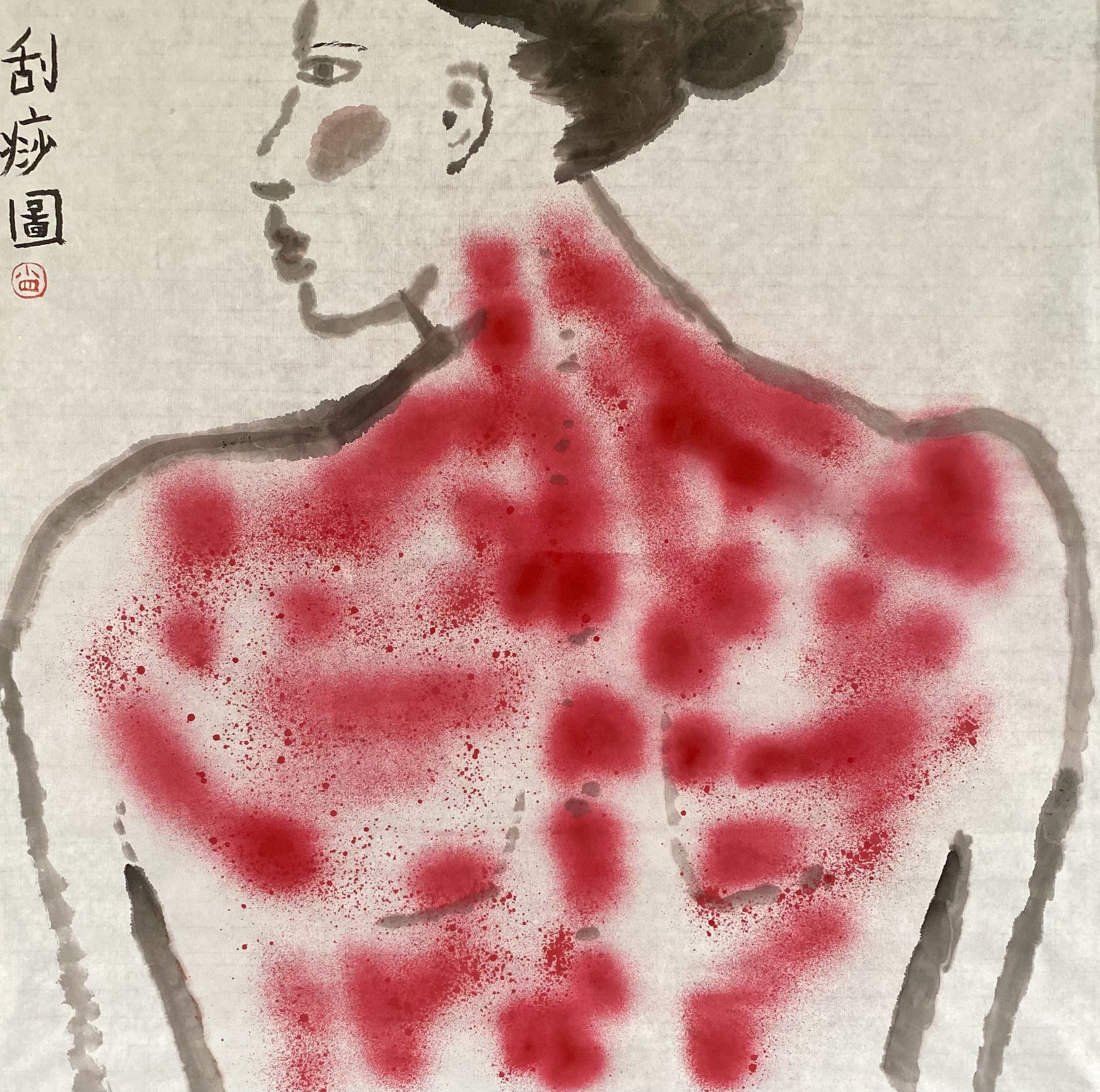 刮痧圖