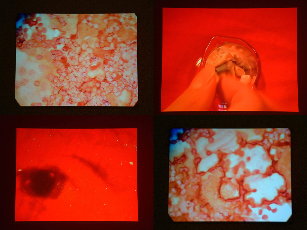 448psychosisII_02